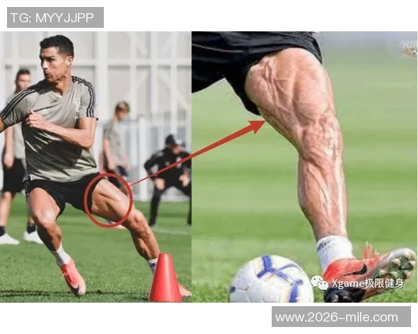 奔跑的联盟:球员腿部肌肉损伤现象引发广泛关注与讨论 奔跑的联盟:球员腿部肌肉损伤现象引发广泛关注与讨论